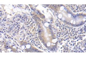 Detection of TFPI in Human Small intestine Tissue using Polyclonal Antibody to Tissue Factor Pathway Inhibitor (TFPI)