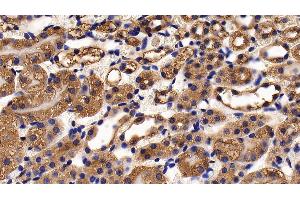 Detection of FUR in Mouse Kidney Tissue using Polyclonal Antibody to Furin (FUR)