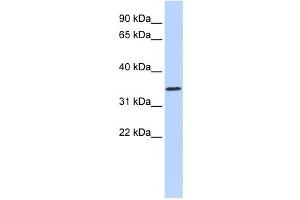 Western Blotting (WB) image for anti-Zinc Finger Protein 660 (ZNF660) antibody (ABIN2458227) (ZNF660 anticorps)