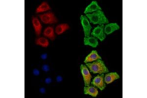 ABIN6263053 and ABIN6277856 staining HepG2 cells by IF/ICC.