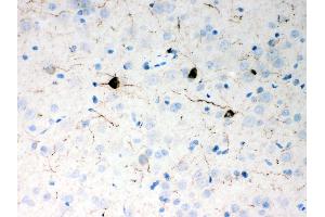 Anti- Neuropeptide Y Picoband antibody,IHC(P) IHC(P): Rat Brain Tissue