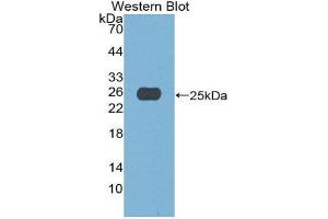 Western Blotting (WB) image for anti-APOBEC1 Complementation Factor (A1CF) (AA 389-587) antibody (ABIN1980366) (A1CF anticorps  (AA 389-587))