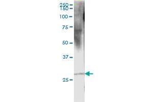 RCVRN (Human) IP-WB Antibody Pair