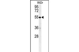 C4B Antibody (C-term) (ABIN652149 and ABIN2840567) western blot analysis in WiDr cell line lysates (35 μg/lane). (C4BPA anticorps  (C-Term))