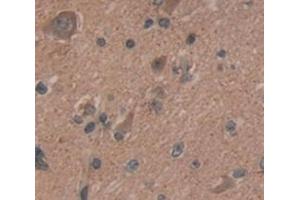 IHC-P analysis of Human Tissue, with DAB staining. (BCL11A anticorps  (AA 1-210))