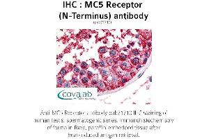 Image no. 1 for anti-Melanocortin 5 Receptor (MC5R) (Extracellular Domain), (N-Term) antibody (ABIN1736815)