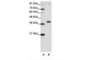 Image no. 1 for anti-Zinc Finger Protein 25 (ZNF25) (C-Term) antibody (ABIN203079) (ZNF25 anticorps  (C-Term))