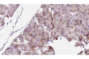 ABIN6273223 at 1/100 staining Human pancreas cancer tissue by IHC-P. (PPIC anticorps  (Internal Region))