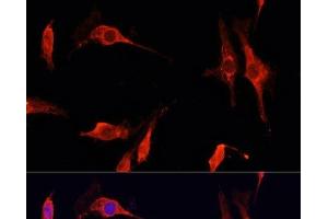 Immunofluorescence analysis of C6 cells using DNASE1 Polyclonal Antibody at dilution of 1:100 (40x lens).