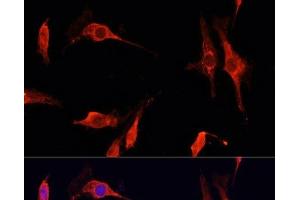 Immunofluorescence analysis of C6 cells using DNASE1 Polyclonal Antibody at dilution of 1:100 (40x lens). (DNASE1 anticorps)