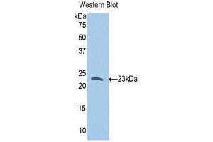 Western Blotting (WB) image for anti-Slit Homolog 1 (SLIT1) (AA 647-835) antibody (ABIN1860574) (SLIT1 anticorps  (AA 647-835))