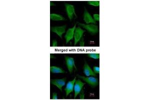 ICC/IF Image Immunofluorescence analysis of paraformaldehyde-fixed HeLa, using FGD4, antibody at 1:200 dilution. (FGD4 anticorps)