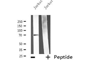 Western blot analysis of extracts from Jurkat cells, using ATG16L1 antibody. (ATG16L1 anticorps  (C-Term))