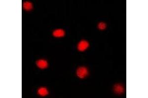 Immunofluorescent analysis of Glucocorticoid Receptor staining in PC12 cells. (Glucocorticoid Receptor anticorps)