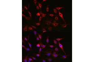 Immunofluorescence analysis of C6 cells using FAK Rabbit pAb (ABIN3022950, ABIN3022951, ABIN3022952 and ABIN6219313) at dilution of 1:100 (40x lens). (FAK anticorps)