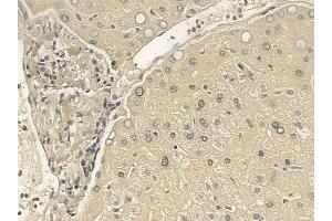 ABIN6265727 and ABIN6273334 at 1/100 staining human normal liver tissue by IHC-P. (TRIM14 anticorps  (C-Term))