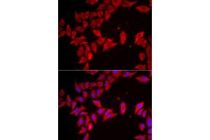 Immunofluorescence analysis of HeLa cells using SLC35A2 antibody (ABIN5974358). (SLC35A2 anticorps)