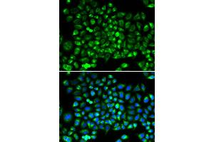Immunofluorescence analysis of HeLa cells using DNM1L antibody (ABIN5971410).