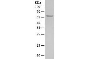 Western Blotting (WB) image for Karyopherin alpha 5 (Importin alpha 6) (KPNA5) (AA 1-536) protein (His-IF2DI Tag) (ABIN7123666)