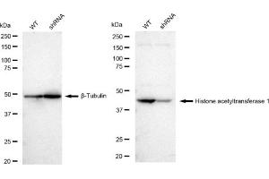 Western blotting analysis using Histone acetyltransferase 1 antibody (ABIN7798921). (Recombinant HAT1 anticorps)