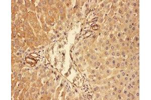 IHC-P: C5a antibody testing of rat liver tissue (C5A anticorps  (N-Term))