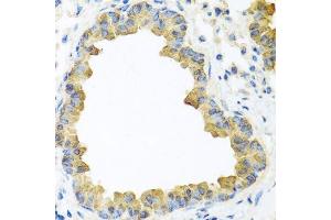 Immunohistochemistry of paraffin-embedded mouse lung using WNT5B antibody. (WNT5B anticorps  (AA 120-359))