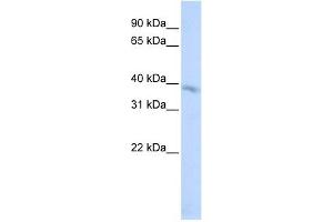 TMEM82 antibody used at 1 ug/ml to detect target protein. (TMEM82 anticorps  (N-Term))
