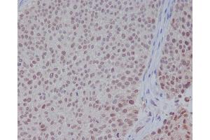 Immunohistochemical analysis of paraffin-embedded human bladder, using ERK1 Antibody.
