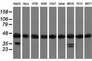 Western blot analysis of extracts (35 µg) from 9 different cell lines by using anti-DNAJA2 monoclonal antibody. (DNAJA2 anticorps)