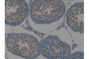 DAB staining on IHC-P; Samples: Rat Testis Tissue