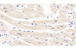 Detection of TNFb in Human Cardiac Muscle Tissue using Monoclonal Antibody to Tumor Necrosis Factor Beta (TNFb) (LTA anticorps  (AA 36-205))