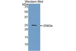 Detection of Recombinant CRP, Porcine using Polyclonal Antibody to C Reactive Protein (CRP) (CRP anticorps  (AA 20-222))