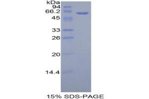 SDS-PAGE analysis of Human Adiponectin Receptor 1 Protein. (Adiponectin Receptor 1 Protein (ADIPOR1))