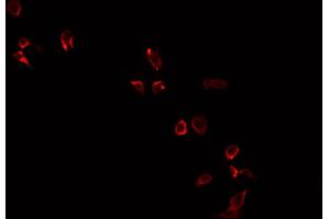 ABIN6269209 staining PC-3 cells by IF/ICC. (NOS1 anticorps  (Internal Region))