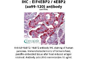 Image no. 1 for anti-Eukaryotic Translation Initiation Factor 4E Binding Protein 2 (EIF4EBP2) (AA 99-120) antibody (ABIN1733956) (eIF4EBP2 anticorps  (AA 99-120))