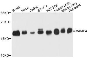 Western blot analysis of extracts of various cell lines, using VAMP4 antibody. (VAMP4 anticorps  (AA 1-115))