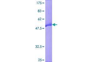 Image no. 1 for RAB9B, Member RAS Oncogene Family (RAB9B) protein (GST tag) (ABIN1317213)
