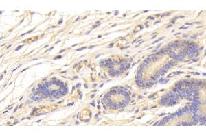 Detection of SPINK5 in Human Uterus Tissue using Polyclonal Antibody to Serine Peptidase Inhibitor Kazal Type 5 (SPINK5) (SPINK5 anticorps  (AA 699-976))