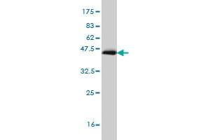 Western Blot detection against Immunogen (35. (RORB anticorps  (AA 136-224))