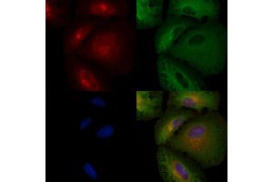 ABIN6257061 and ABIN6274183 staining  cells by IF/ICC. (CKMT2 anticorps  (Internal Region))
