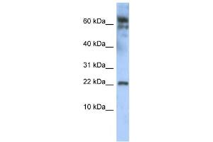 Western Blotting (WB) image for anti-Leucine Zipper, Down-Regulated in Cancer 1 (LDOC1) antibody (ABIN2458354) (LDOC1 anticorps)