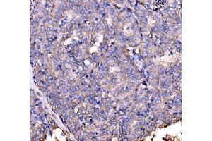 IHC analysis of Drebrin/DBN1 using anti-Drebrin/DBN1 antibody (ABIN7602638). (DBN1 anticorps  (AA 9-649))