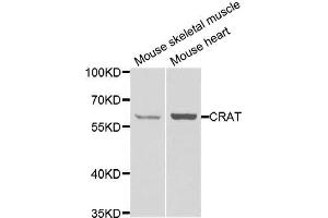 Western blot analysis of extracts of various cell lines, using CRAT antibody. (CRAT anticorps)