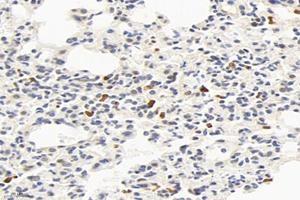 Immunohistochemistry analysis of paraffin-embedded mouse lung using,Factor XIIIa (ABIN7073528) at dilution of 1: 2400
