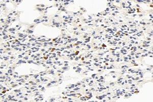 Immunohistochemistry analysis of paraffin-embedded mouse lung using,Factor XIIIa (ABIN7073528) at dilution of 1: 2400 (F13A1 anticorps)