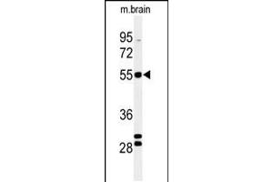 Western blot analysis of FA2H Antibody in mouse brain tissue lysates (35ug/lane) (FA2H anticorps  (AA 121-148))