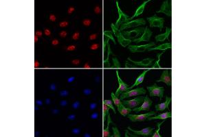 ABIN6257676 and ABIN6275499 staining 3 by IF/ICC.
