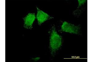 Immunofluorescence of purified MaxPab antibody to SNX13 on HeLa cell. (SNX13 anticorps  (AA 1-957))