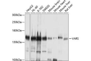 Western blot analysis of extracts of various cell lines, using VARS antibody (ABIN1683239, ABIN3018665, ABIN3018666 and ABIN6220533) at 1:1000 dilution. (VARS anticorps  (AA 1-280))