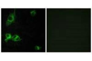 Immunofluorescence analysis of COS-7 cells, using LAMA1 antibody. (Laminin alpha 1 anticorps)